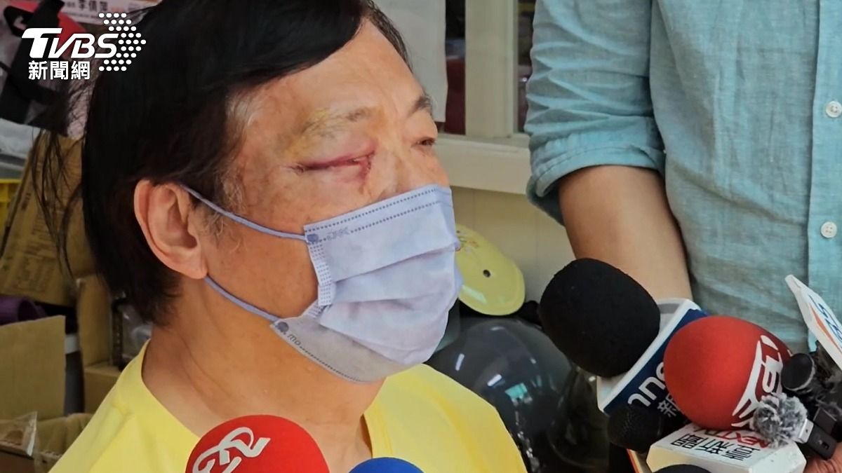 見義勇為的里長，遭跟騷慣犯毆成重傷。（圖／TVBS）