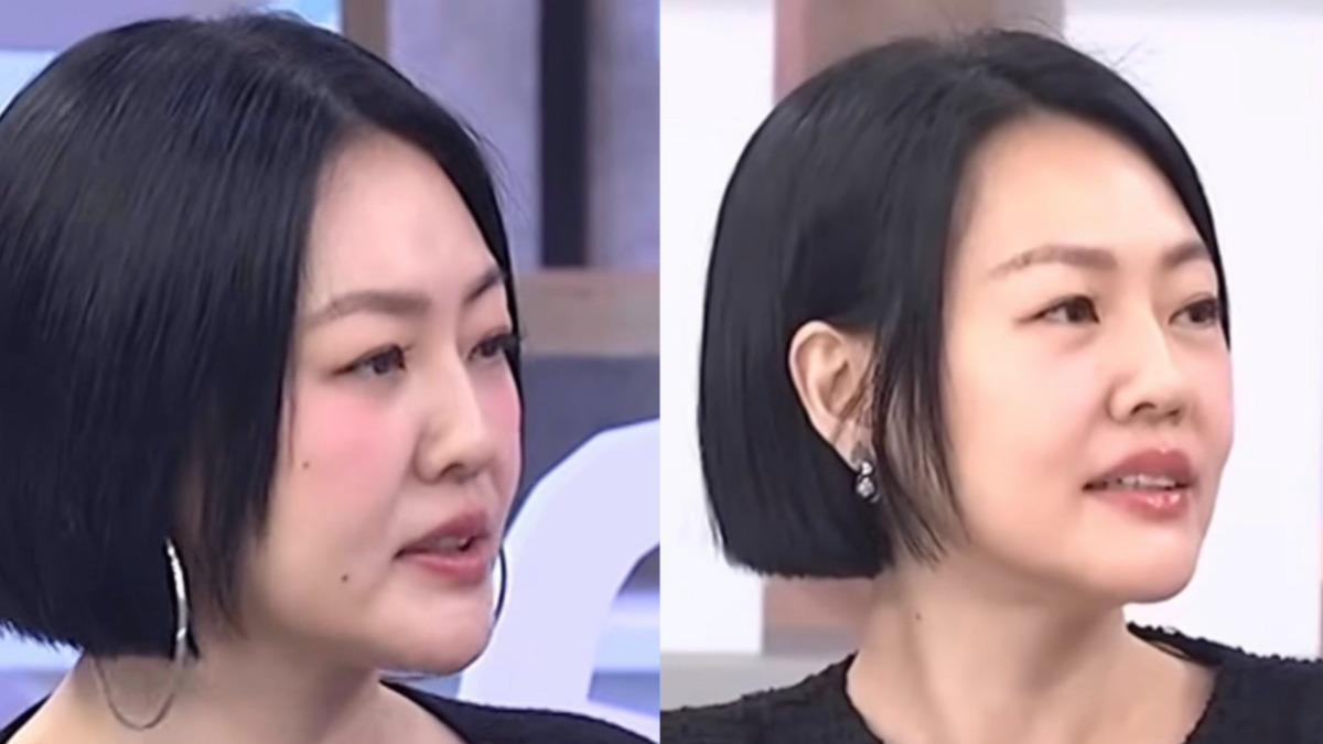 小S復出「臉上多2顆痣」疑改運?網曬今昔對比照 經紀人解答了