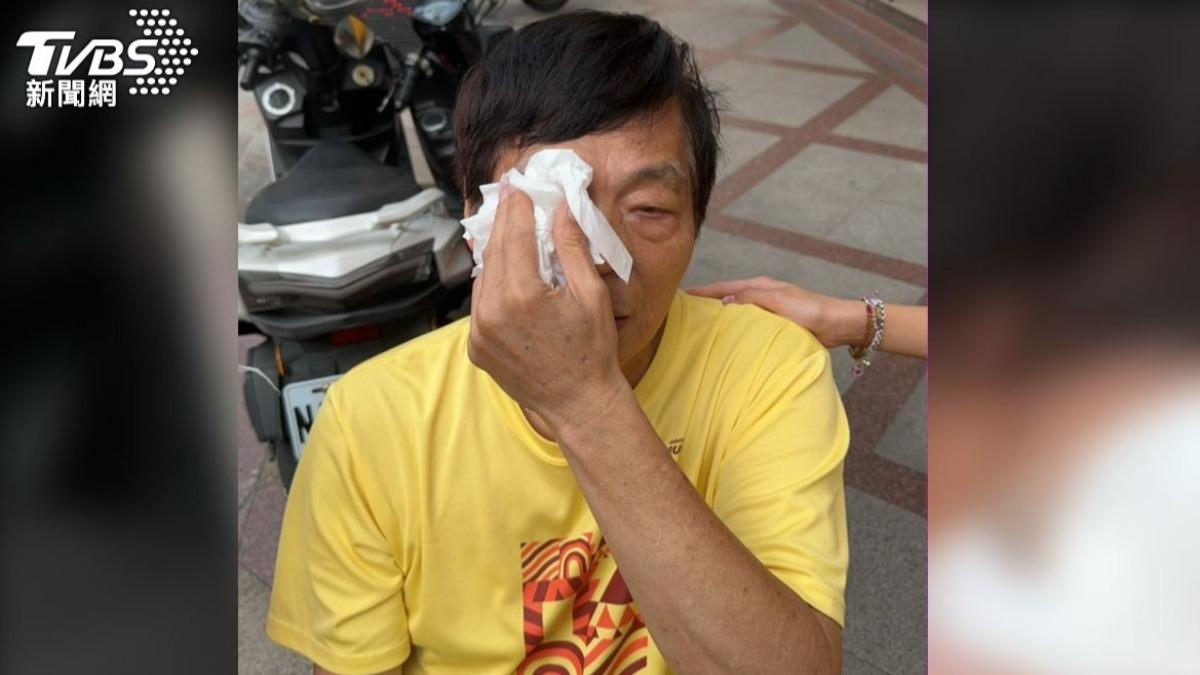 見義勇為的里長也被游男打到毀容。(圖/TVBS)
