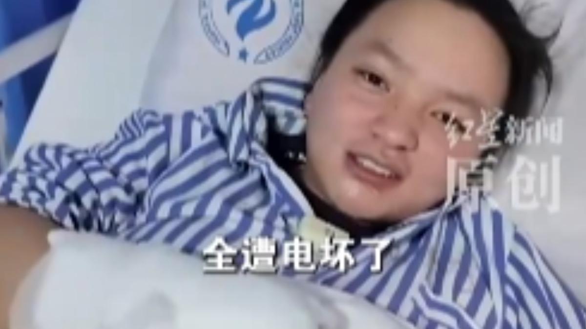中國大陸女子,用非原廠充電器充電滑手機時,突然遭到強烈電擊,電流從手部貫穿到腳底,導致全身多處嚴重燒燙傷,緊急送往ICU才撿回一命。(圖/紅星新聞)