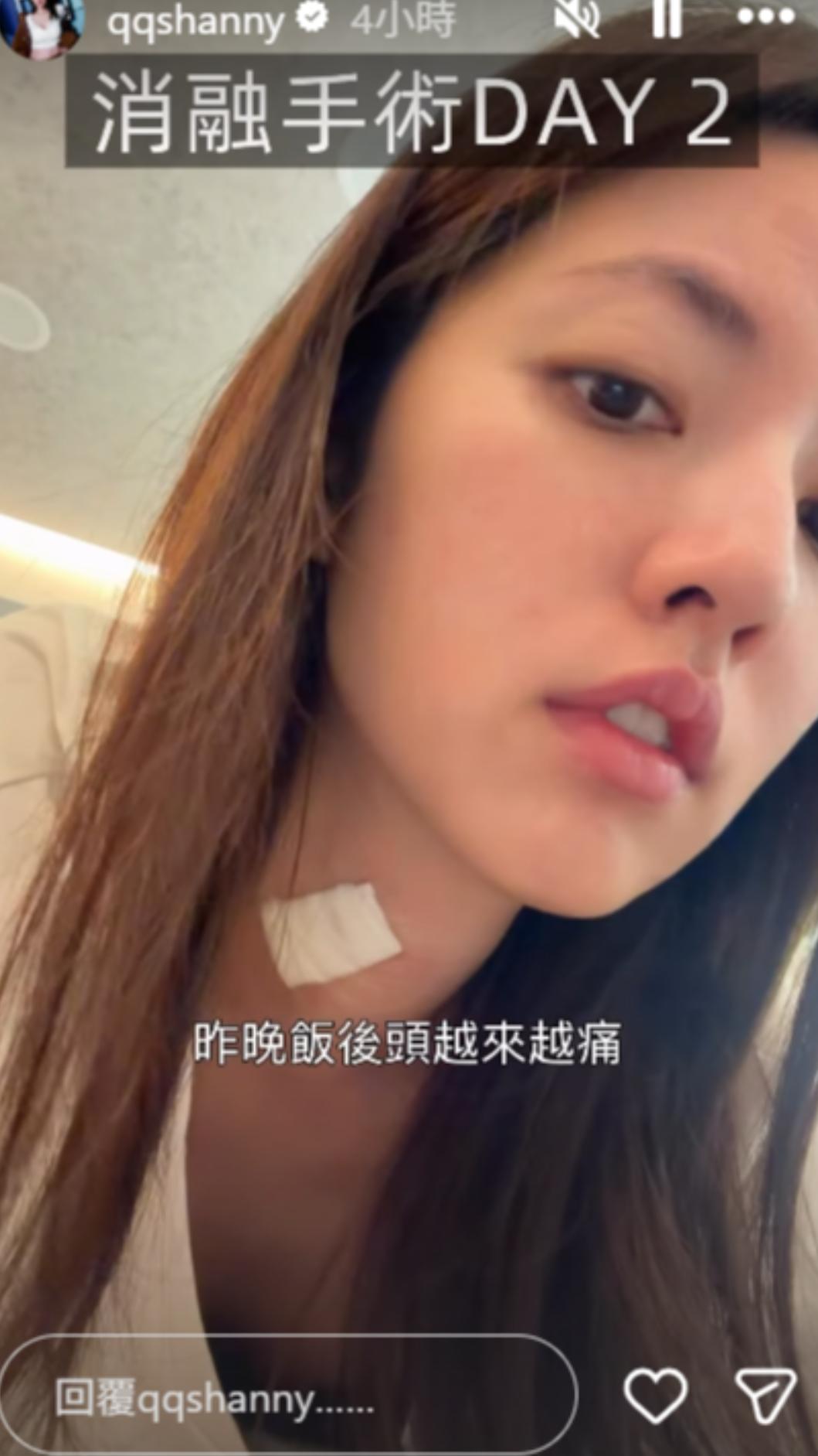 阿諾手術後出現副作用。(圖/翻攝自阿諾IG)