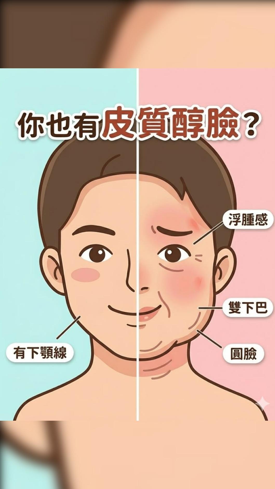 皮質醇臉主要是壓力導致。(圖/醫師提供)