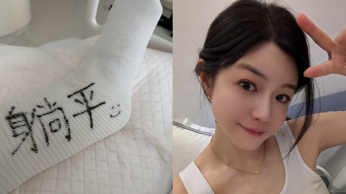 陳妍希三月份因為運動受傷,左腳包石膏。(圖/翻攝自陳妍希微博)