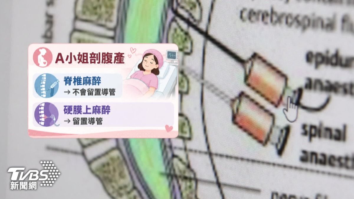 其他醫師認為麻醉不太可能完全失效。（圖／TVBS）