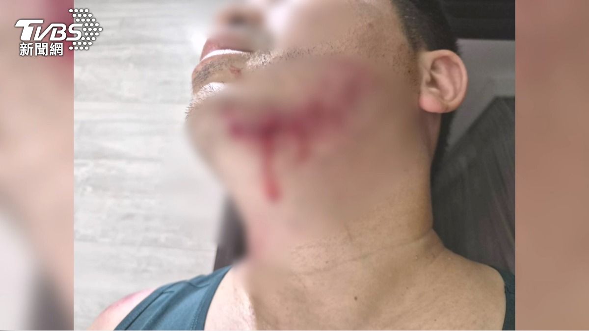 台中男跑步返家「脖子被勒」噴血　兇手竟是燈桿鐵線。(圖／TVBS)