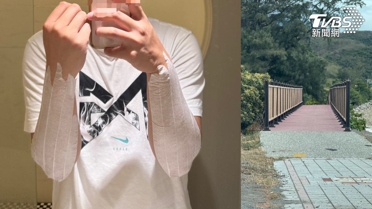 屏東獅頭山步道欄杆藏危機！遊客手臂遭扎傷　紅腫發癢急就醫（圖／翻攝 threads@record.199）