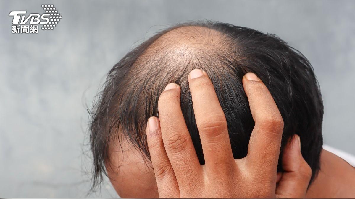 示意圖／達志影像Shutterstock