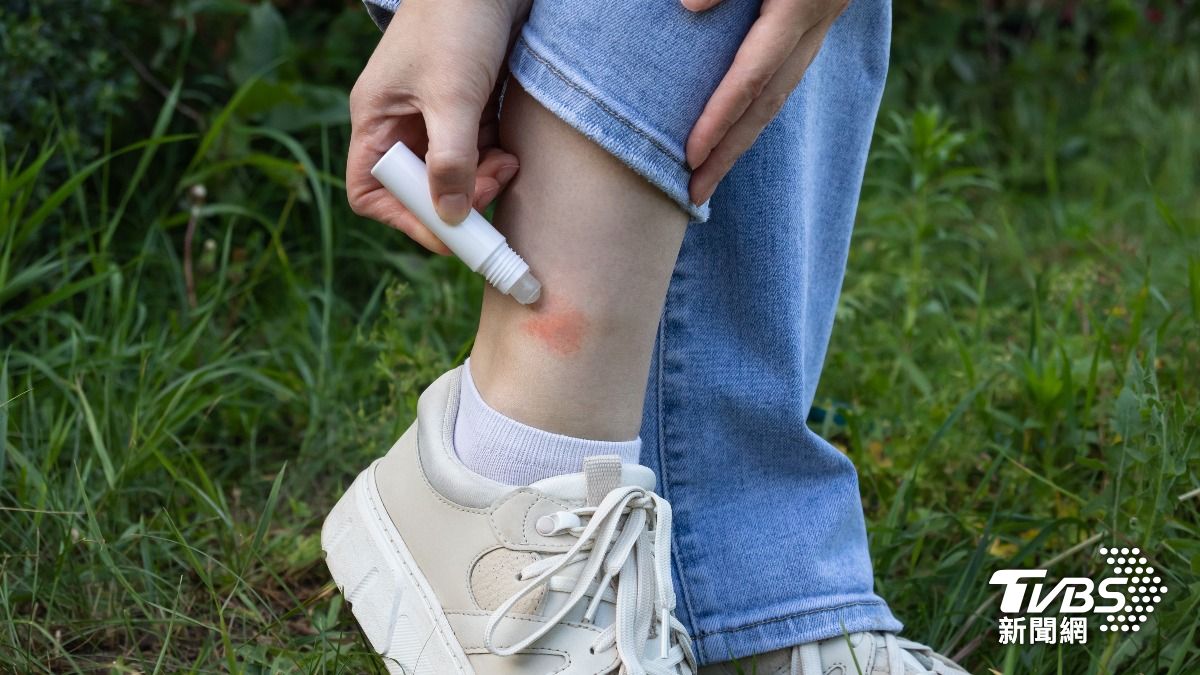 蚊子狂咬變紅豆冰?醫揭「止癢3招」:別再畫十字了