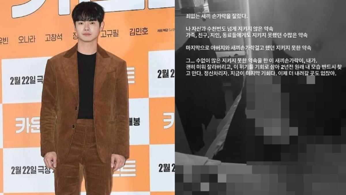 才宣布退圈!31歲男星突「自切小拇指」 曬血腥片崩潰道歉