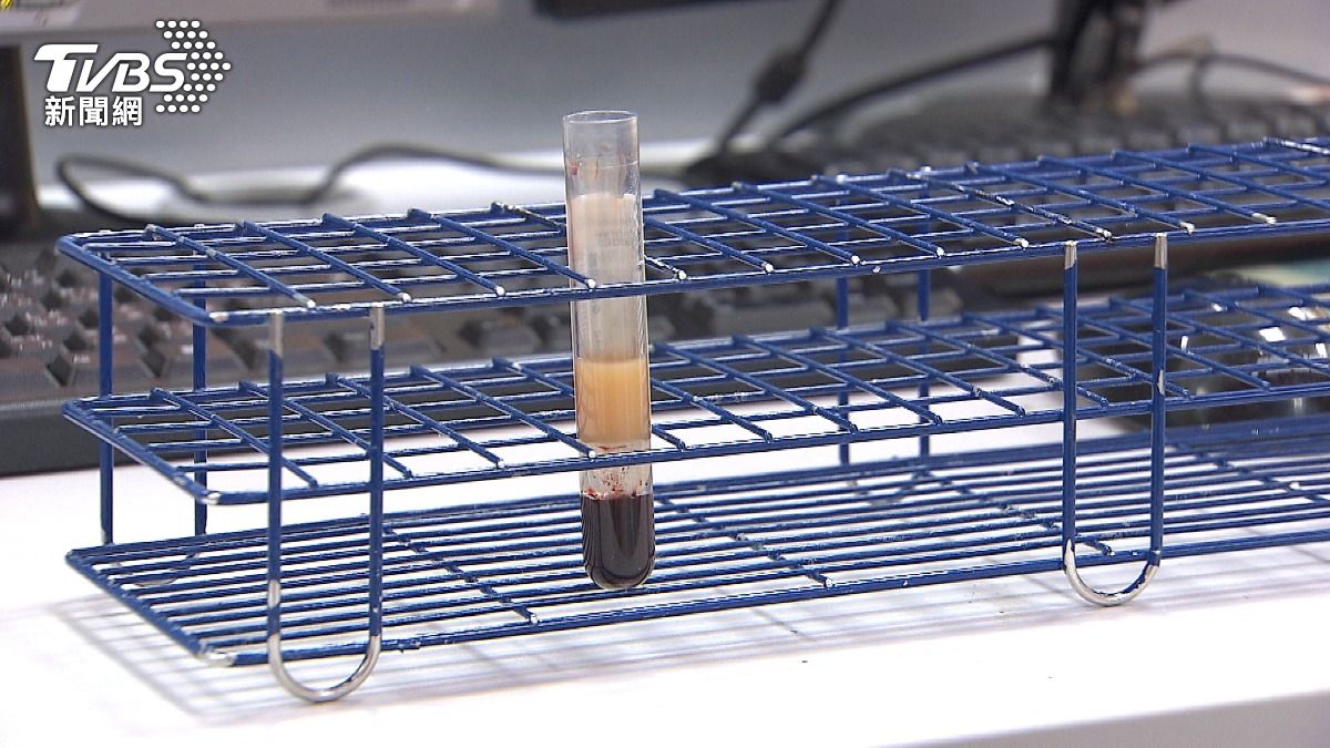 高血脂沒症狀卻傷血管!醫揭「這數值」太高 恐釀心肌梗塞、中風