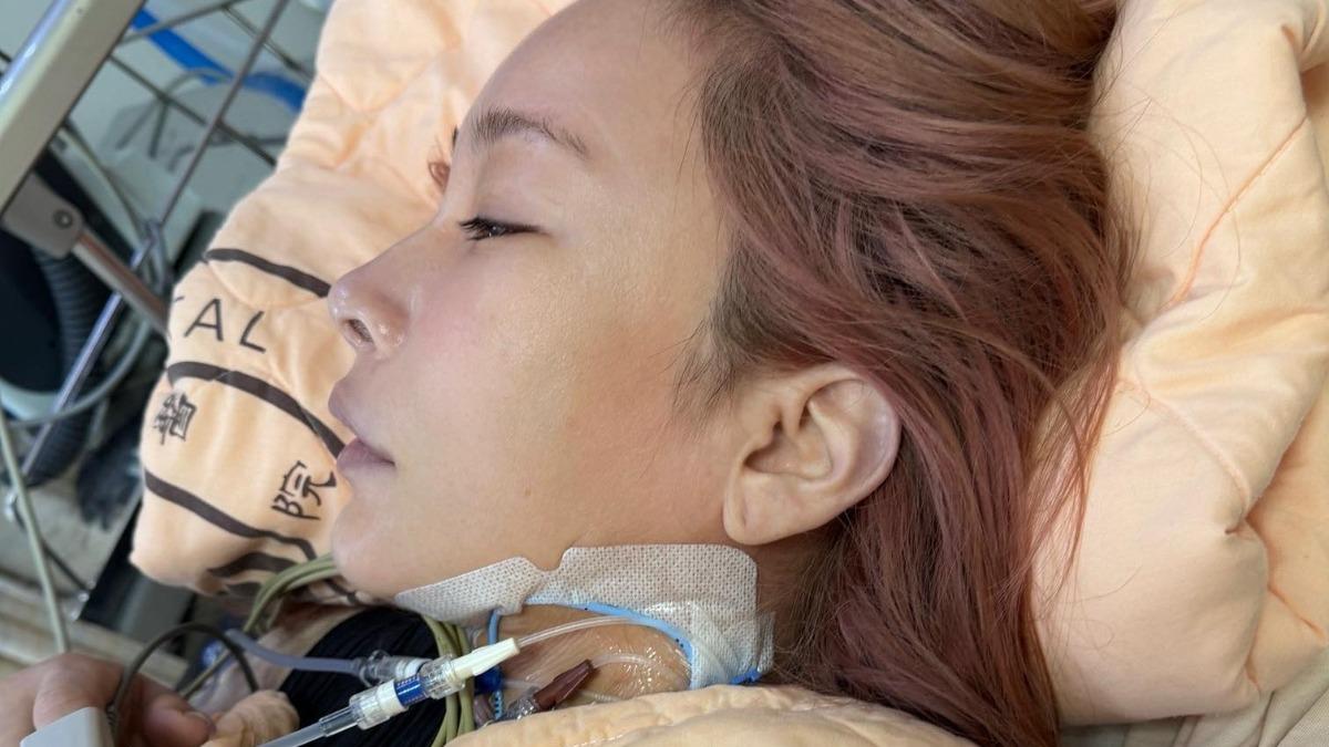 敗血症插管險喪命!温嵐首曝病因:「1習慣」差點害死自己