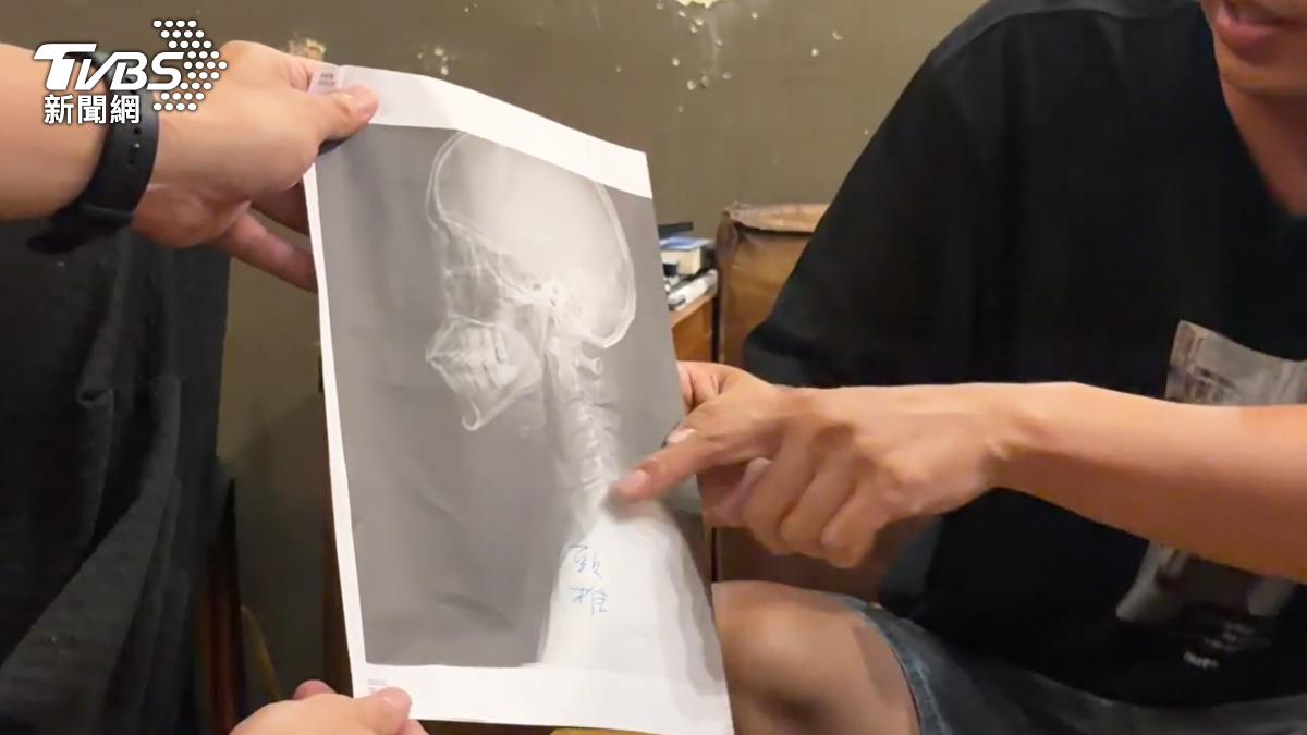 馬姓男子則拿出X光片及驗傷單,證實自己在衝突中也有受傷,表示對方曾掐住他的脖子,導致手部發麻,因此前往就醫。(圖/TVBS)