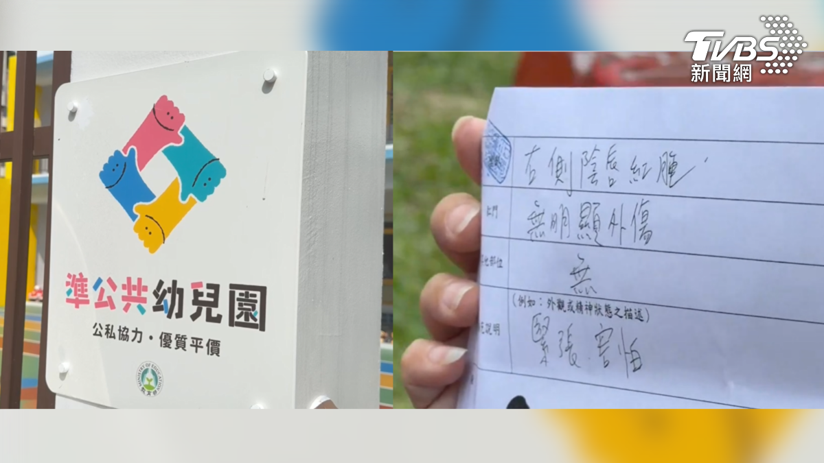 高雄一所準公幼發生學童間的不當接觸事件,一名大班女童25日在校兩度遭同班男童碰觸隱私部位,直到晚間洗澡時喊痛,媽媽才發現女兒身體紅腫(圖/TVBS)