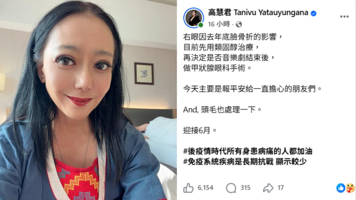 高慧君採取類固醇治療。(圖/翻攝自臉書)