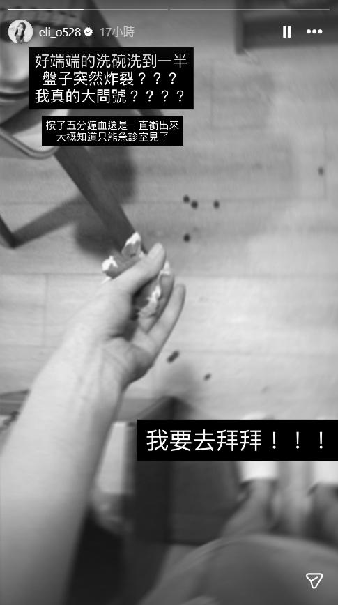 倪暄透露,按了5分鐘血還是止不住,最後前往急診室包紮。(圖/翻攝自倪暄IG)