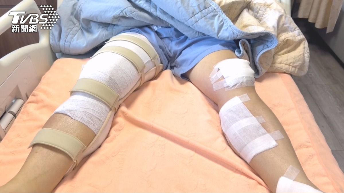 盤查毒蟲遭衝撞！彰化所長「膝蓋粉碎性骨折」　嫌竟無保請回。(圖／TVBS)