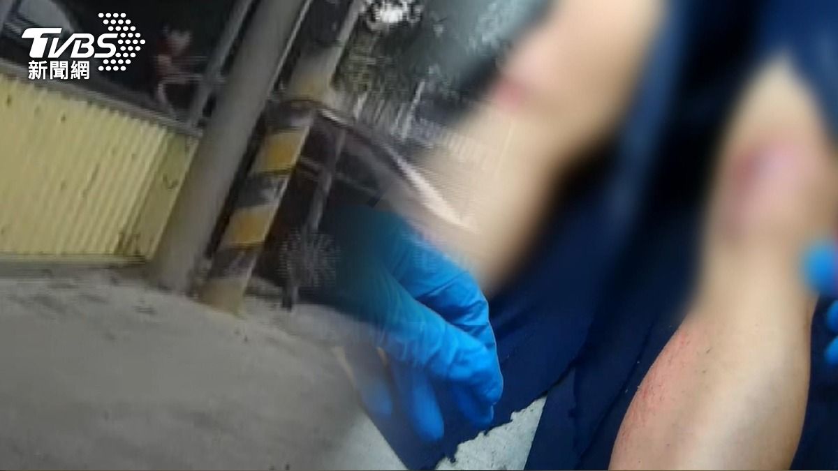 警遭毒犯輾斷腿!嫌無保「帶水果闖病房求原諒」。(圖/TVBS)