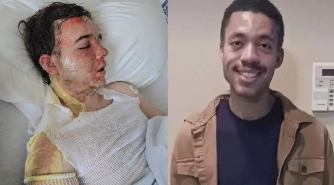 麥當勞店經理Jacob Smith（左）無預警遭到同事Jalani Bluett（右）潑灑滾燙熱油。（圖／翻攝 New York Post）