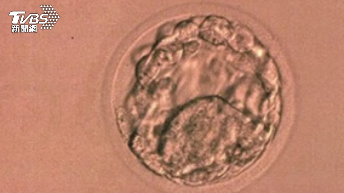 以為問題在老婆!阿兵哥不孕4年精子遭「3殺」 檢查結果全傻眼