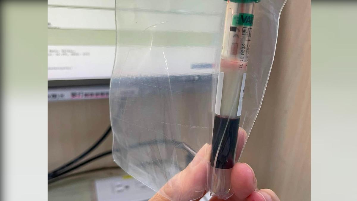 26歲女腸胃炎掛急診！抽血竟浮「奶昔層」　醫驚：數值破千