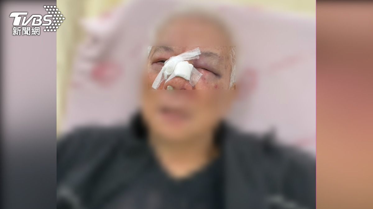 中市傳恐怖攻擊! 7旬雜貨店老闆慘遭惡男持鑰匙插鼻、狂打斷肋骨送醫