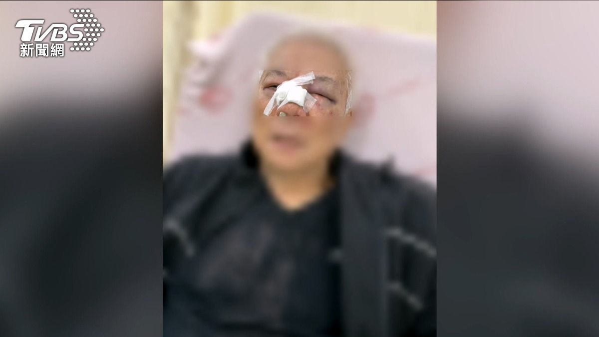  台中隨機攻擊! 68歲翁遭毆受傷 嫌犯被逮自言自語護送就醫 (圖為被害人)