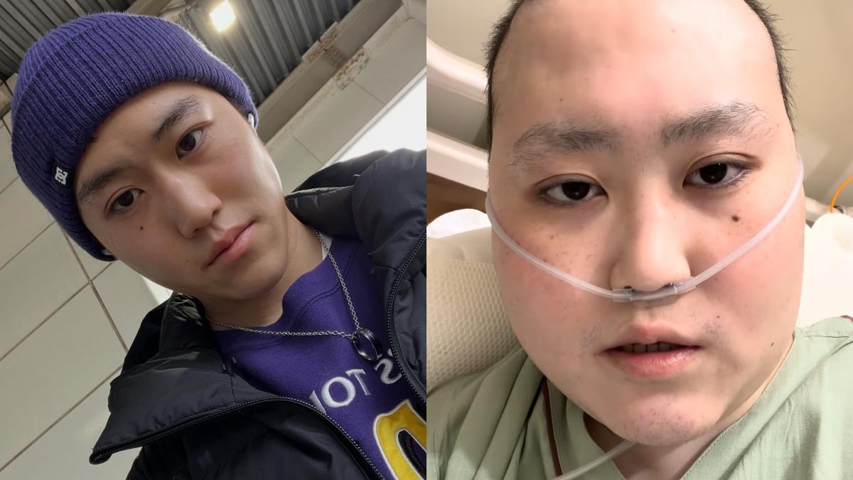 百萬分之一機率！21歲YTR罹罕病「骨肉瘤」抗癌4年過世　家屬心碎證實