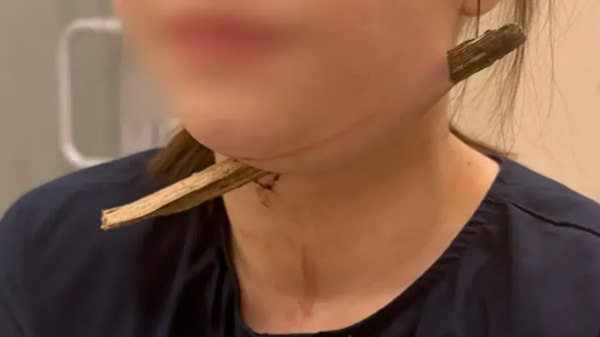 俄羅斯一名女學生遭一根斷裂的樹枝「由後往前」當場刺穿脖子。(圖/翻攝自太陽報)