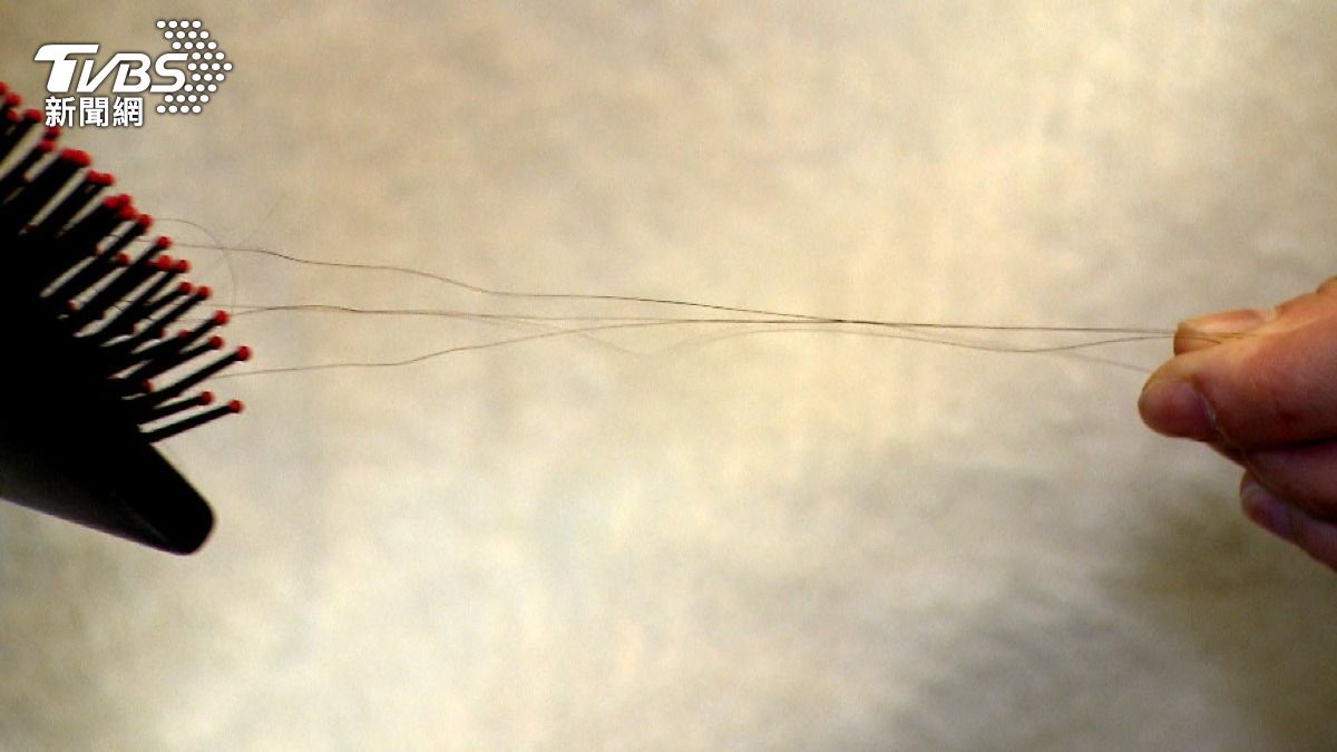 夏天防曬別漏頭皮!經常「做這件事」長期曝曬 恐曬傷、局部落髮 (圖/TVBS)