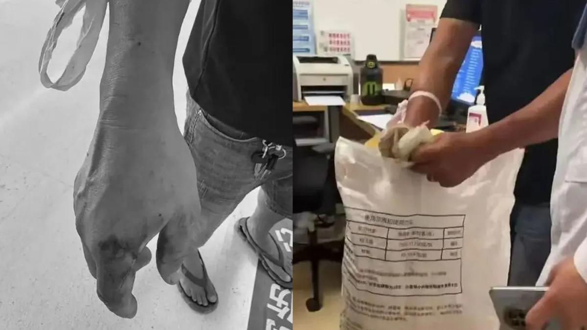被蛇咬傷秒抓起來!陸男手猛滲血 拎活蛇就醫「進診間還在扭」