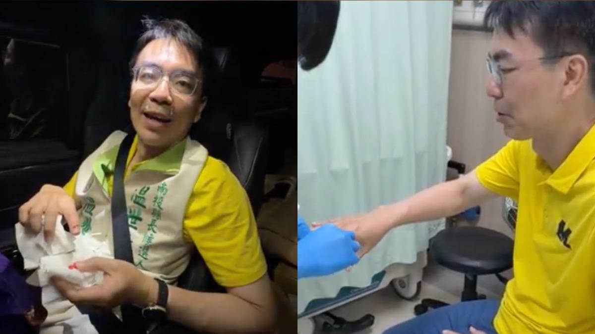 綠南投縣長參選人跑行程被狗咬!被送急診大讚:台灣健保難波萬