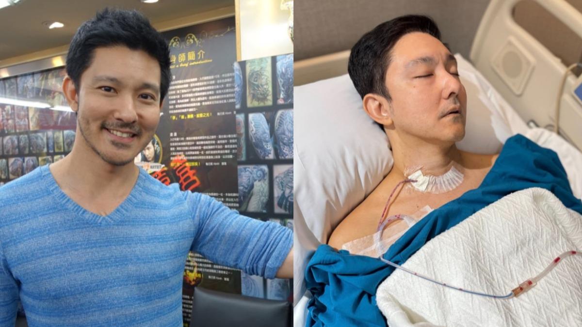 甲狀腺癌淋巴轉移!男星肺部「又見結節」 醫曝2治療關鍵