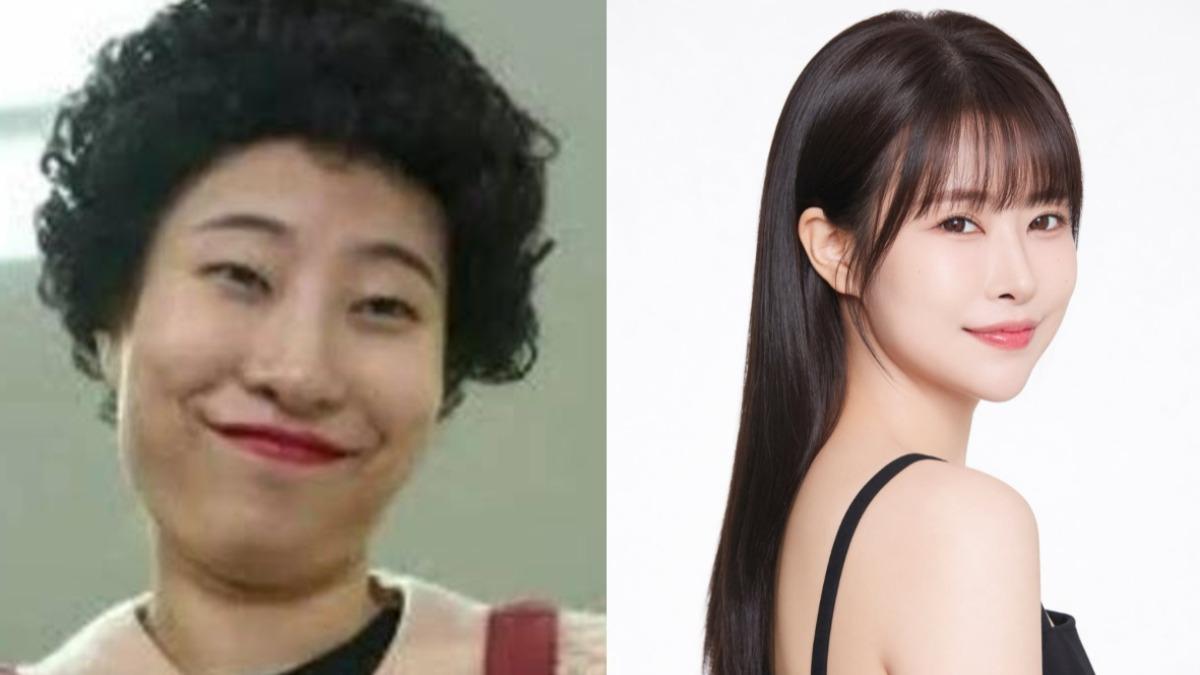 《請回答1988》女星又進化！曾隆乳「慘變4個胸部」　曝光最新術後照