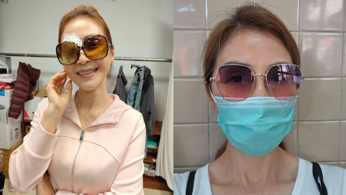 梁佑南-梁佑南眼睛-梁佑南手術-梁佑南近況-八點檔女星
