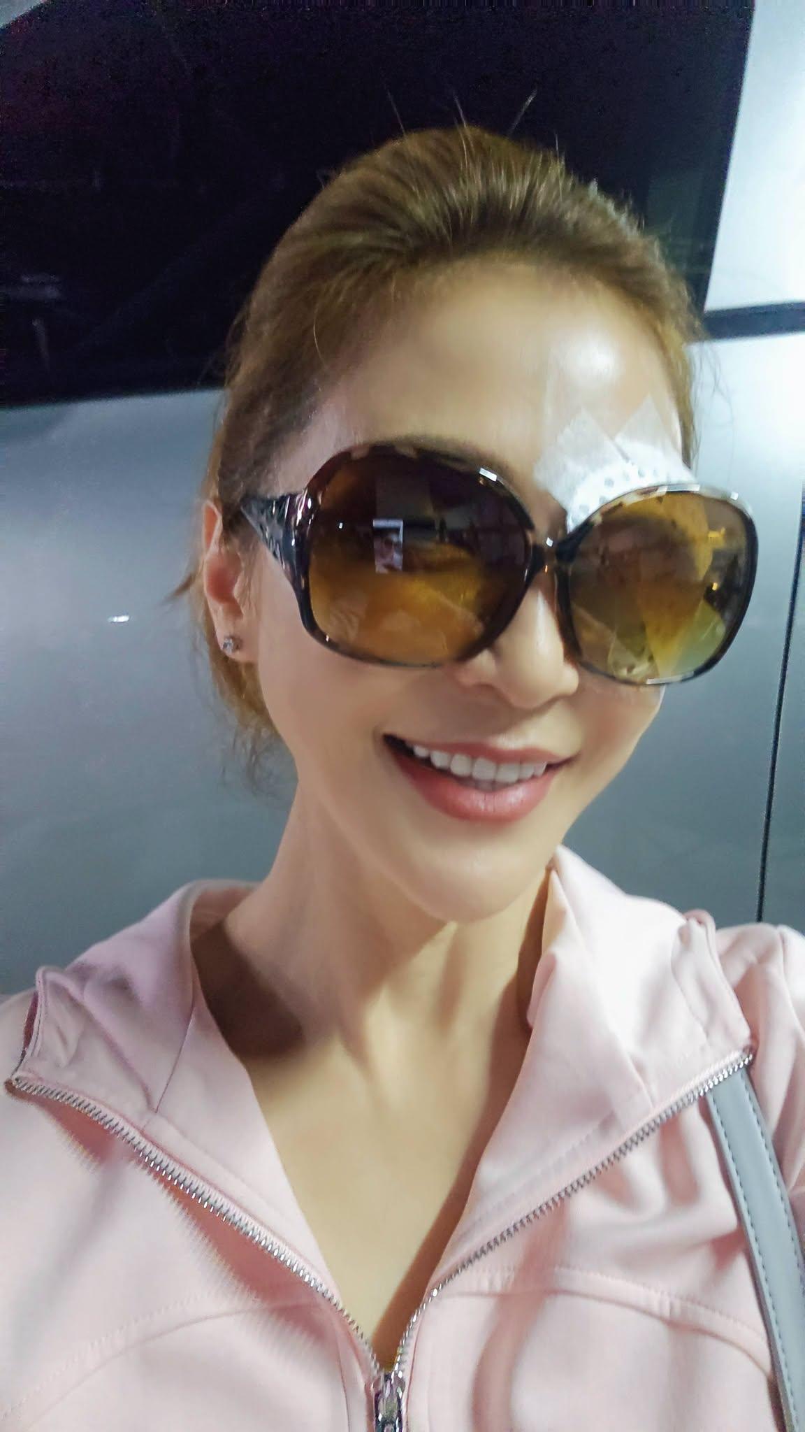 梁佑南-梁佑南眼睛-梁佑南手術-梁佑南近況-八點檔女星