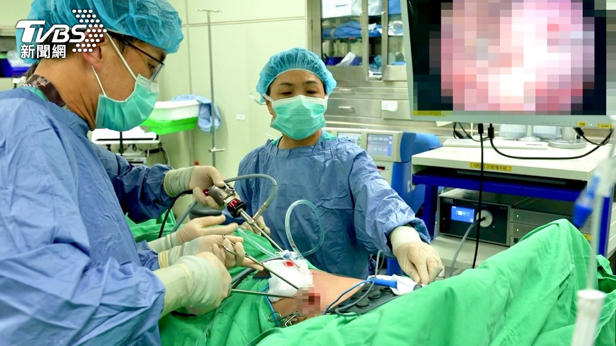 隱形殺手新剋星！胸腔外科打造「肺癌早篩一條龍」與精準微創醫療新典範 (圖/TVBS)
