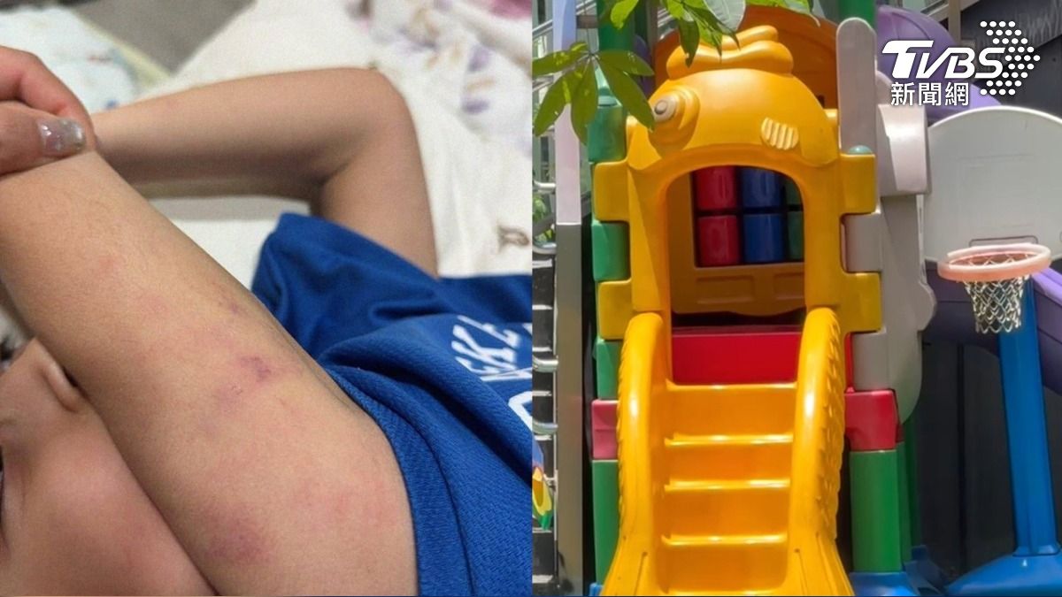 幼童午睡不睡覺被捏到大片瘀青!基隆2教保員遭終身禁教