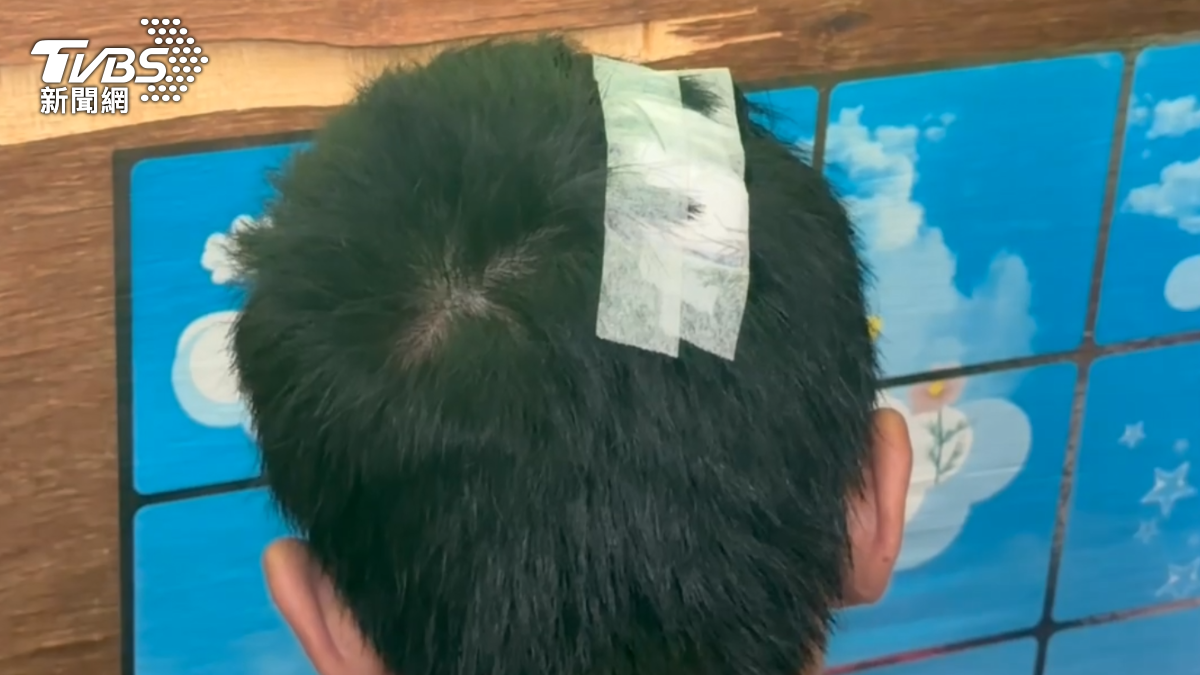 13歲少年騎單車遭10野狗追咬!狂奔800米逃命 全身傷返家