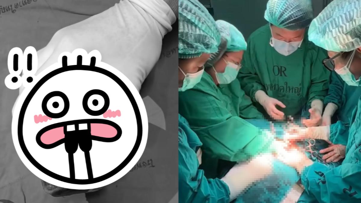 泰女私密處痛3年飄惡臭!竟卡12公分巨石 自曝被下黑魔法
