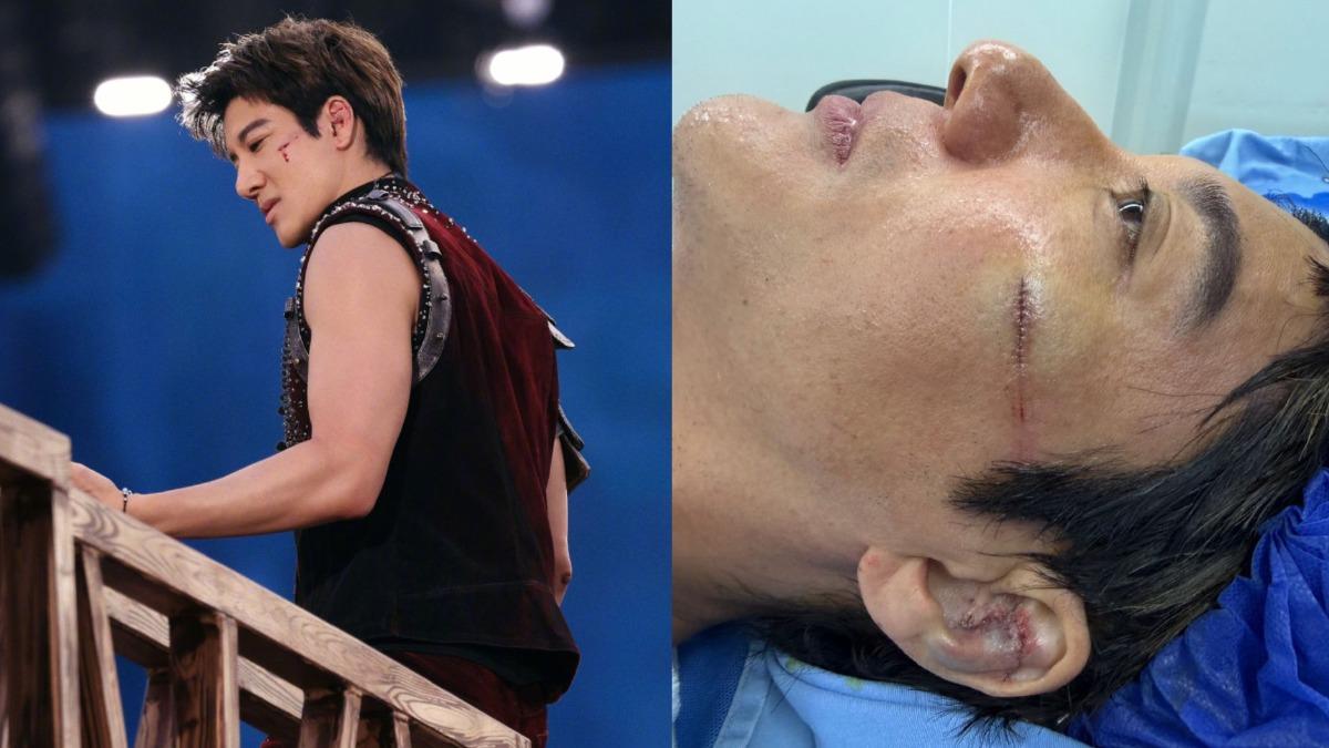 王力宏演唱會重摔!「撞碎左耳大爆血」急診慘縫39針 傷勢曝光