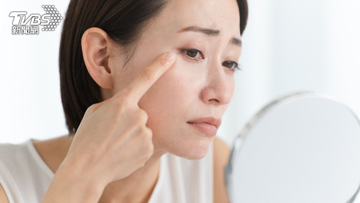 下巴反覆冒出粉刺和痘痘，總讓人感到挫折。（示意圖／shutterstock達志影像）