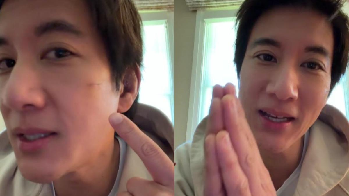 王力宏重摔縫39針！親上火線揭恢復狀況　為巡演做重大決定
