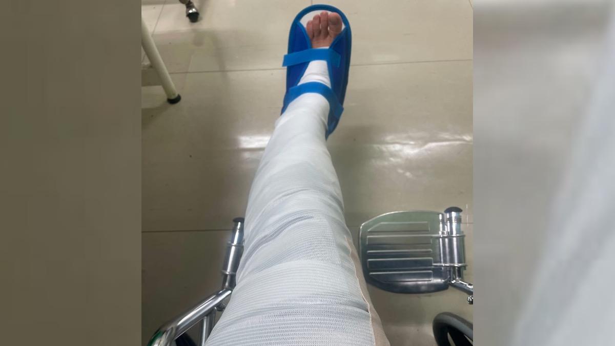 陳玉珍左腳打上石膏靜待復原中，競選縣長行程停擺。（圖／翻攝陳玉珍臉書粉專）