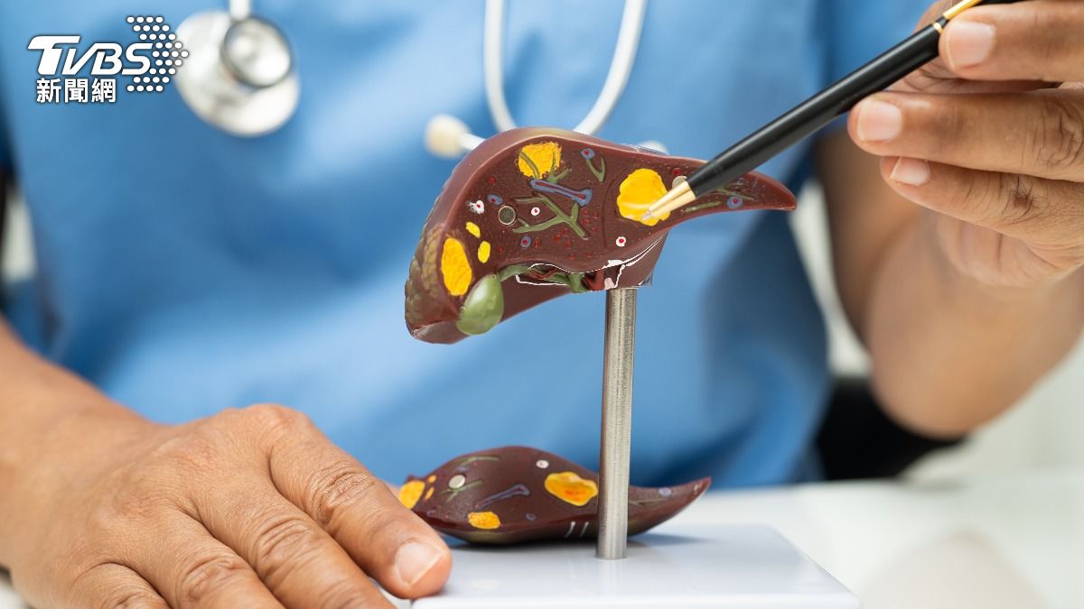 肝癌長年位居國人十大癌症死因前列。（示意圖／shutterstock達志影像）