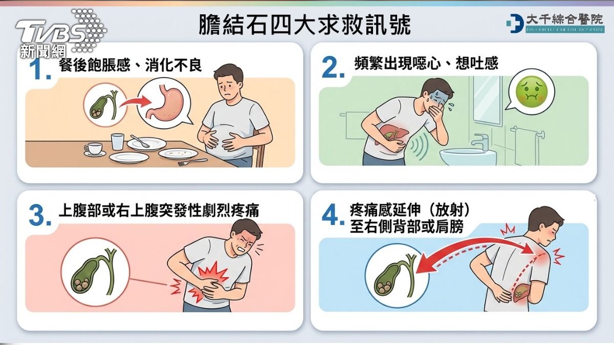 膽結石四大求救訊號。(圖/TVBS)