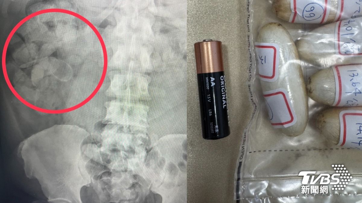 法籍男狂吞101顆海洛因闖關 5天拉出2千萬毒品