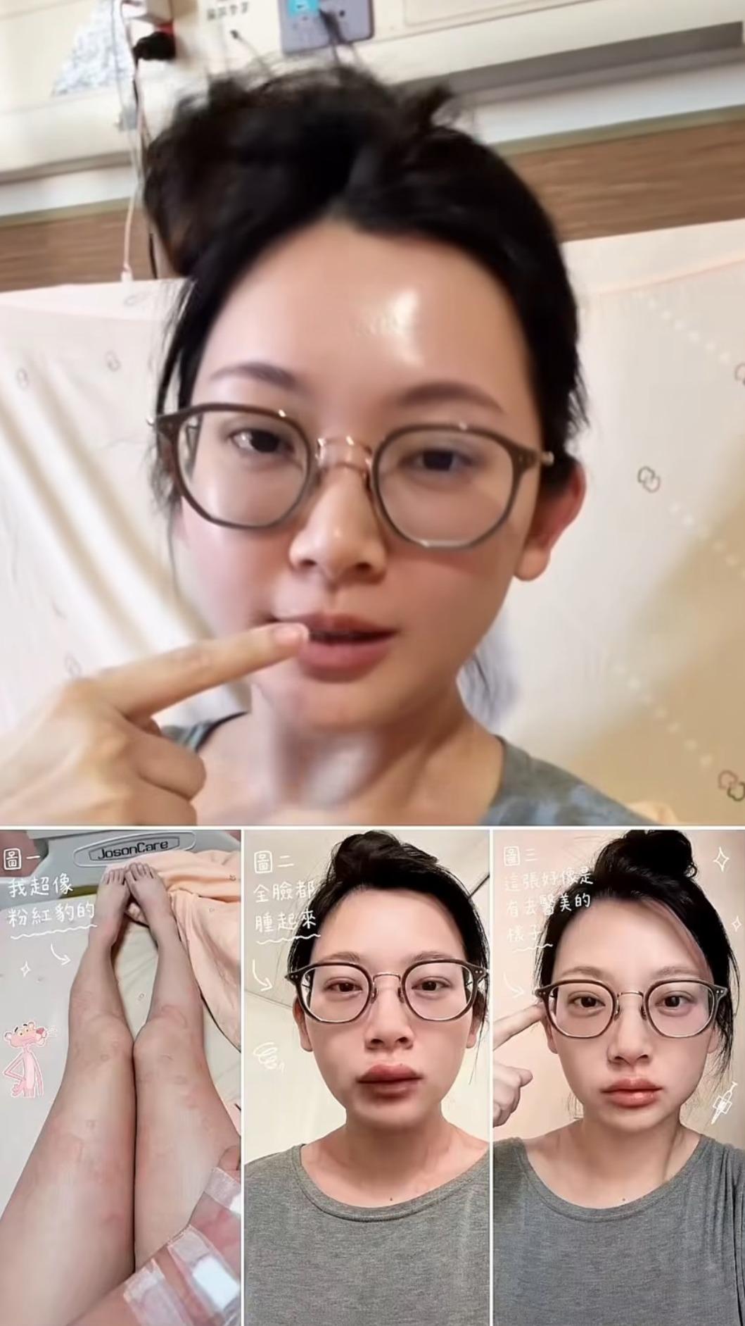 優格姐姐輕忽症狀。(圖/翻攝自IG)