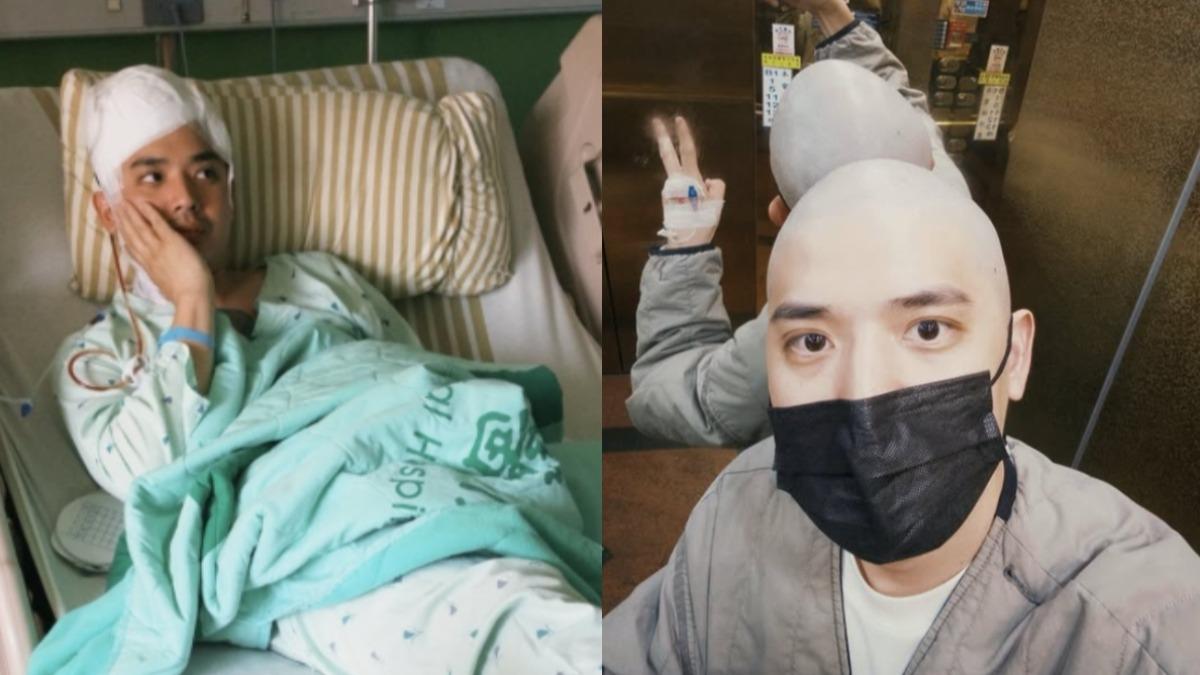 台灣40歲男演員「罹患腦瘤」！腫瘤5公分大　站不起來崩潰