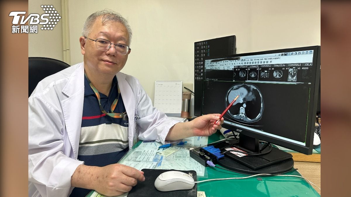 台中婦腹痛休克一查竟是「肝癌腫瘤破裂出血」　緊急手術救回