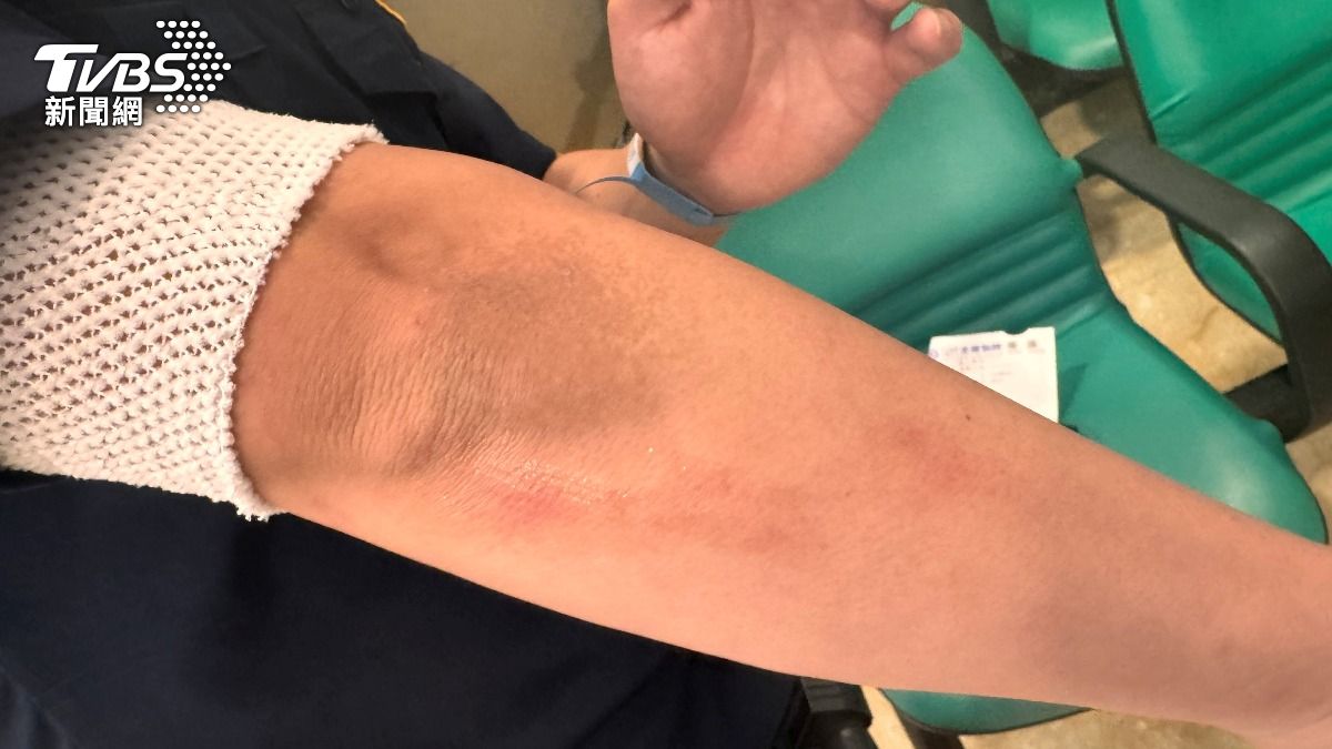 值勤員警在勸架過程中，被李姓男子襲擊，導致頭部、手部挫傷。（圖／TVBS）